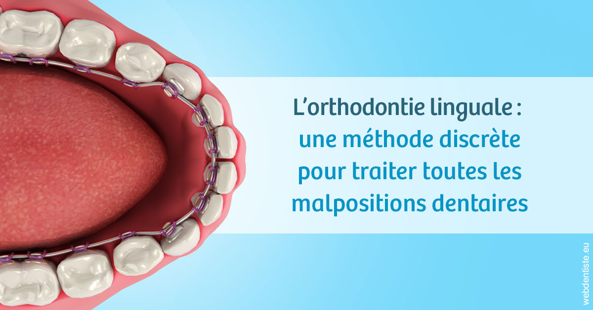 https://dr-geffray-justine.chirurgiens-dentistes.fr/L'orthodontie linguale 1