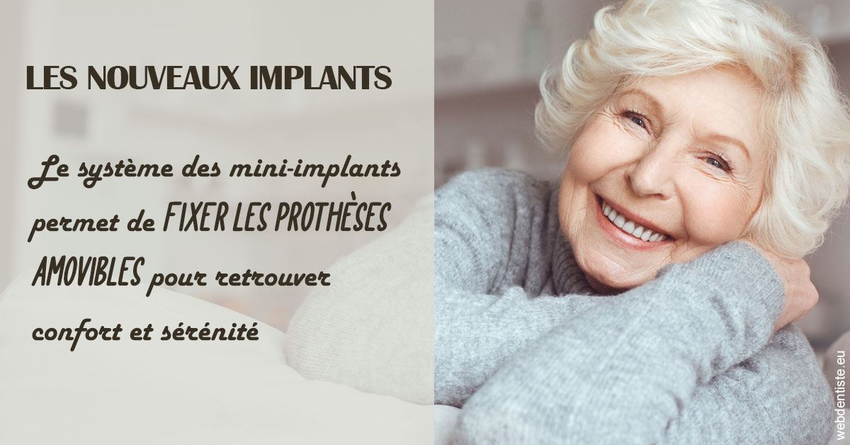 https://dr-geffray-justine.chirurgiens-dentistes.fr/Les nouveaux implants 1