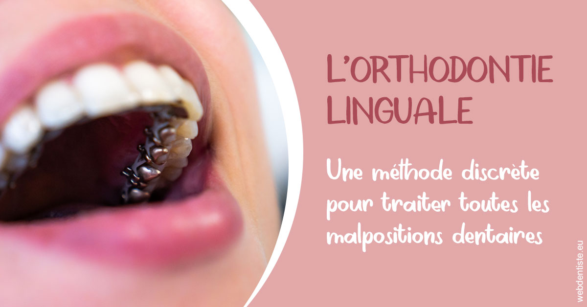 https://dr-geffray-justine.chirurgiens-dentistes.fr/L'orthodontie linguale 2