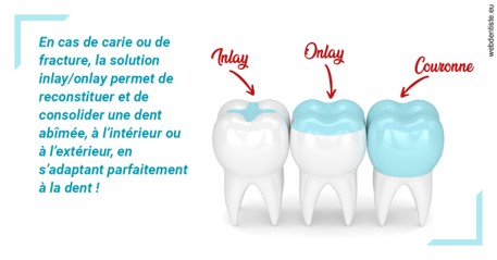 https://dr-geffray-justine.chirurgiens-dentistes.fr/L'INLAY ou l'ONLAY