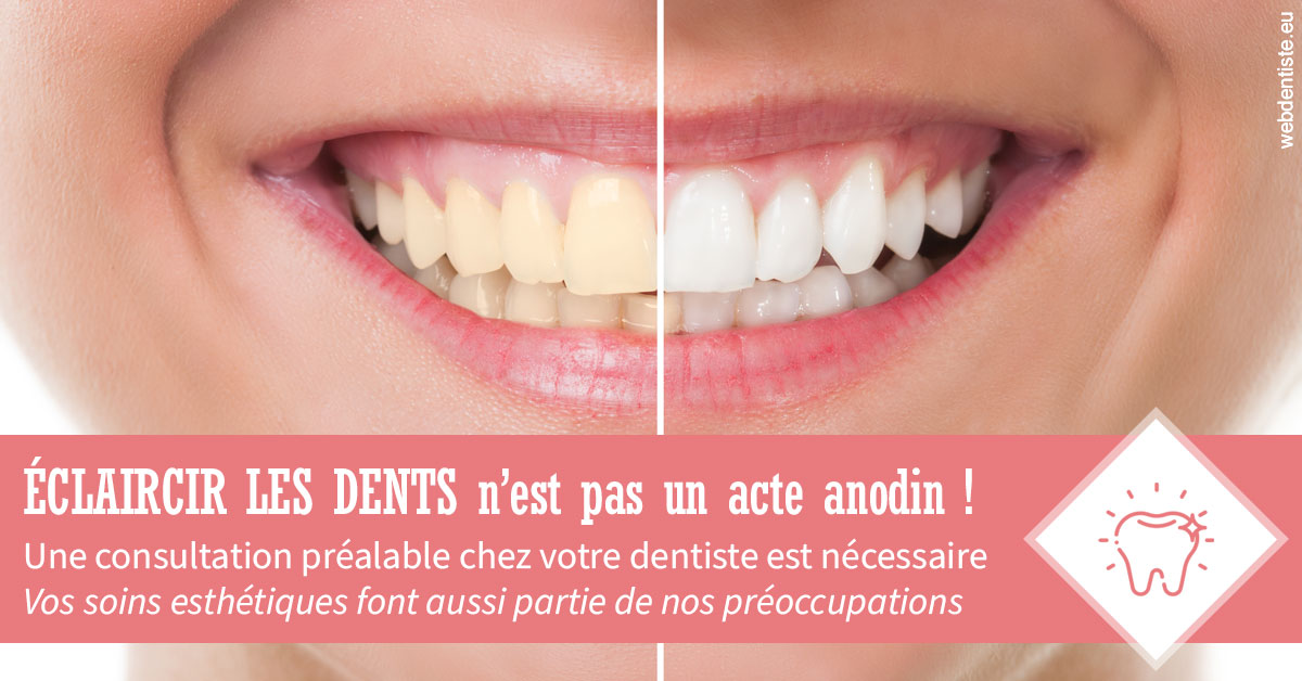 https://dr-geffray-justine.chirurgiens-dentistes.fr/Eclaircir les dents 1