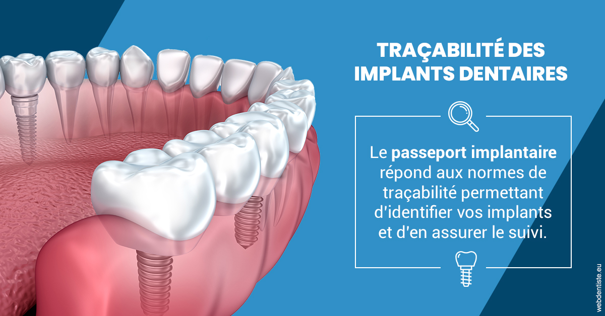 https://dr-geffray-justine.chirurgiens-dentistes.fr/T2 2023 - Traçabilité des implants 1