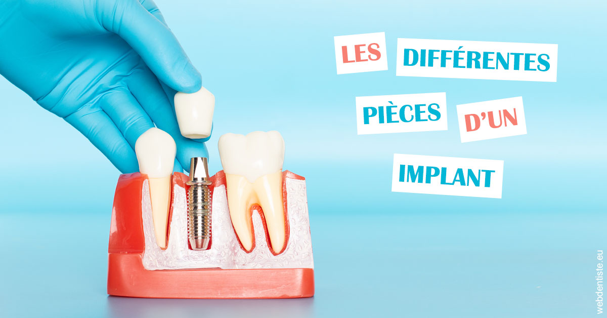 https://dr-geffray-justine.chirurgiens-dentistes.fr/Les différentes pièces d’un implant 2