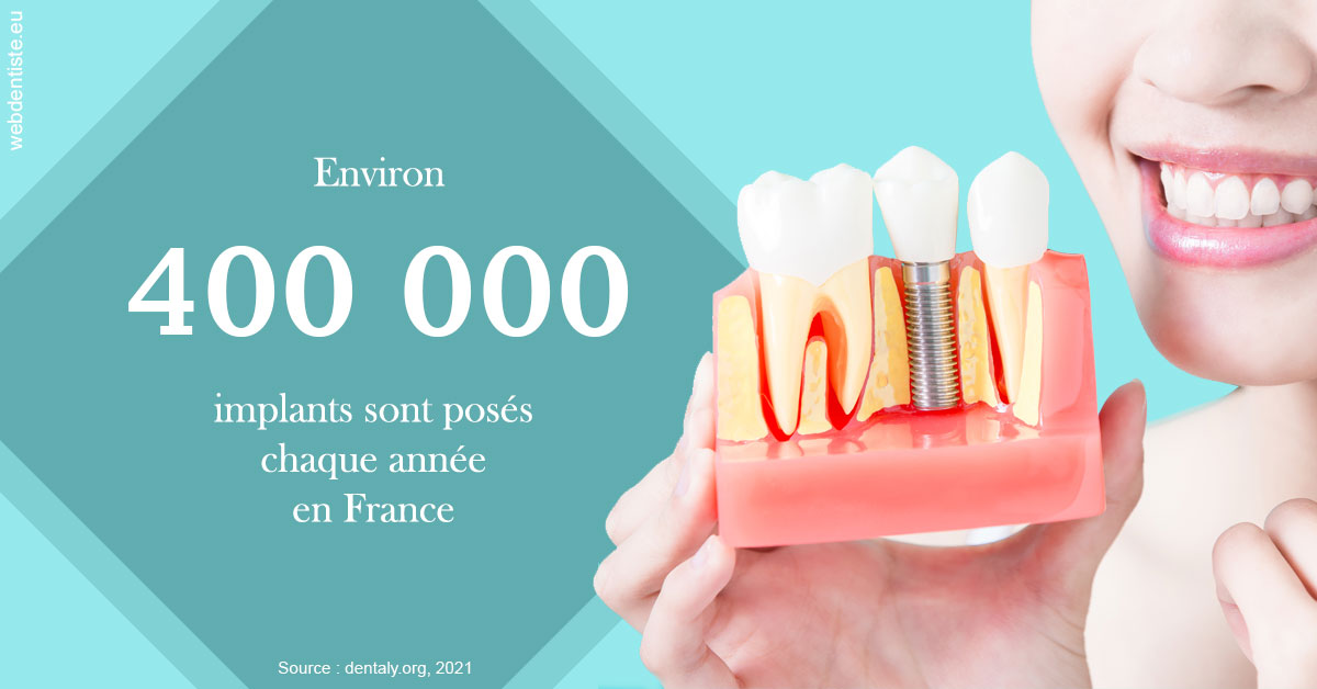 https://dr-geffray-justine.chirurgiens-dentistes.fr/Pose d'implants en France 2