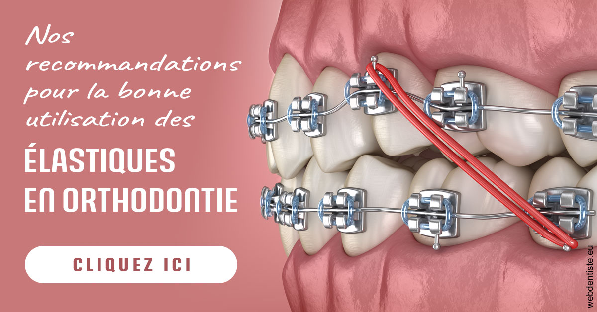 https://dr-geffray-justine.chirurgiens-dentistes.fr/Elastiques orthodontie 2
